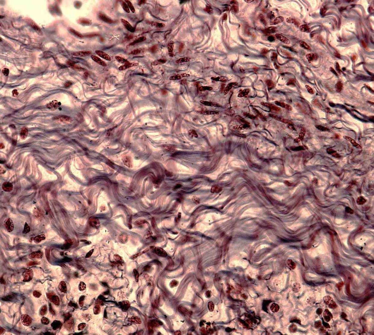 microscopic collagen fibers