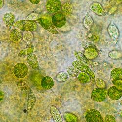 microscopic picture of green Eukaryotes