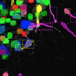 Digital image of cancer cells migrating.