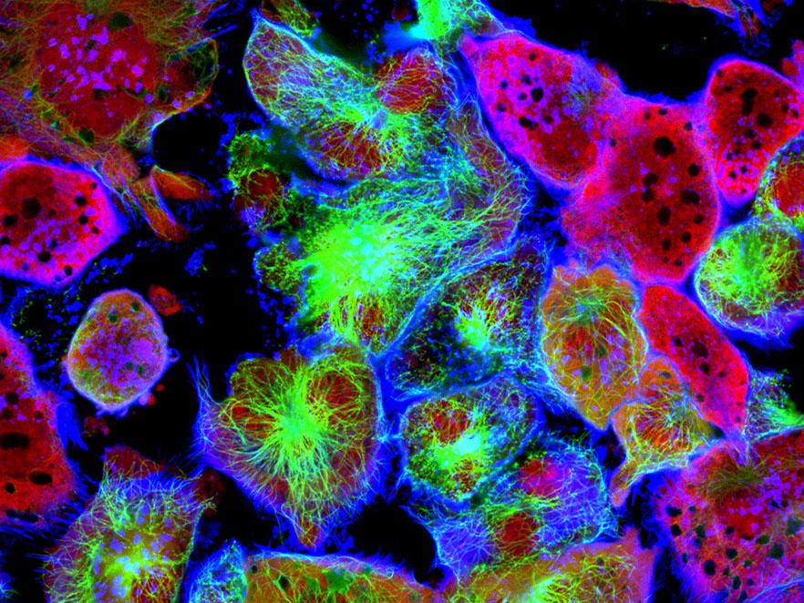 False color image of cancer cells
